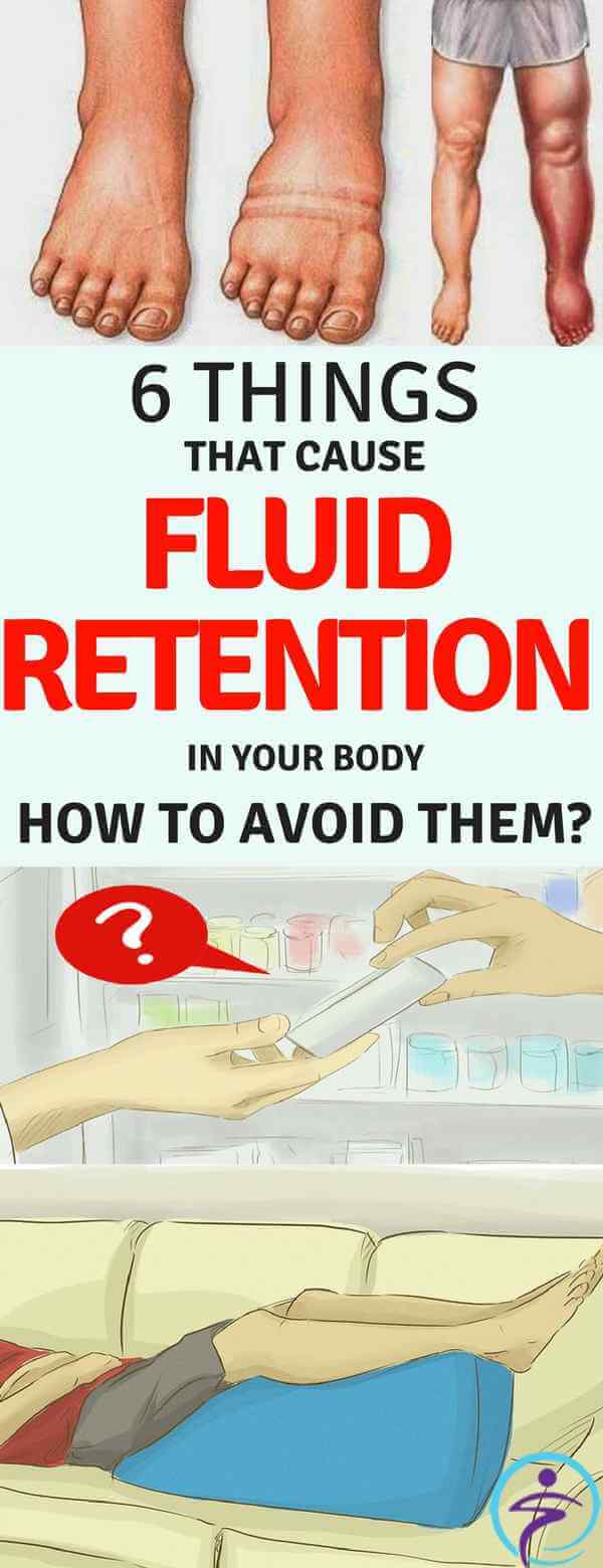 6 THINGS THAT CAUSE FLUID RETENTION IN YOUR BODY AND HOW TO AVOID THEM