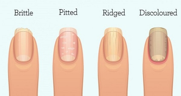 fingernails